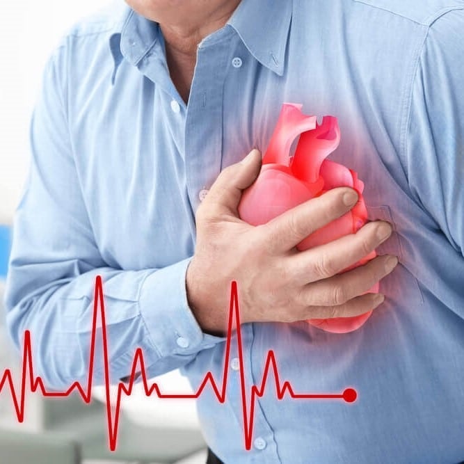 دراسة تكشف أكثر يوم تنتشر فيه الإصابة بنوبة قلبية خطيرة