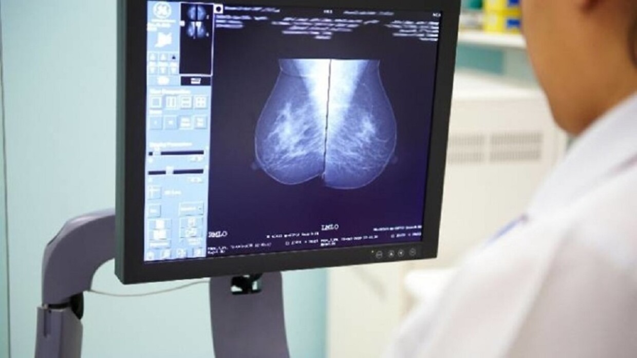 جرعة إشعاع واحدة بدلا من أسابيع علاج إشعاعي لسرطان الثدي