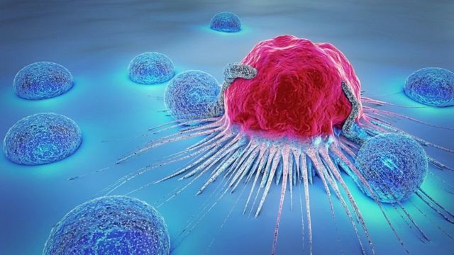 اكتشاف طريقة جديدة تخفّض خطر تطور السرطان بنسبة 60%
