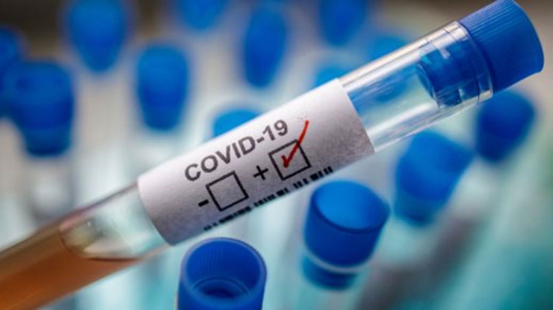 الصحة الروسية تحذر من مخاطر الإصابة بأمراض المناعة الذاتية بعد "كوفيد-19"