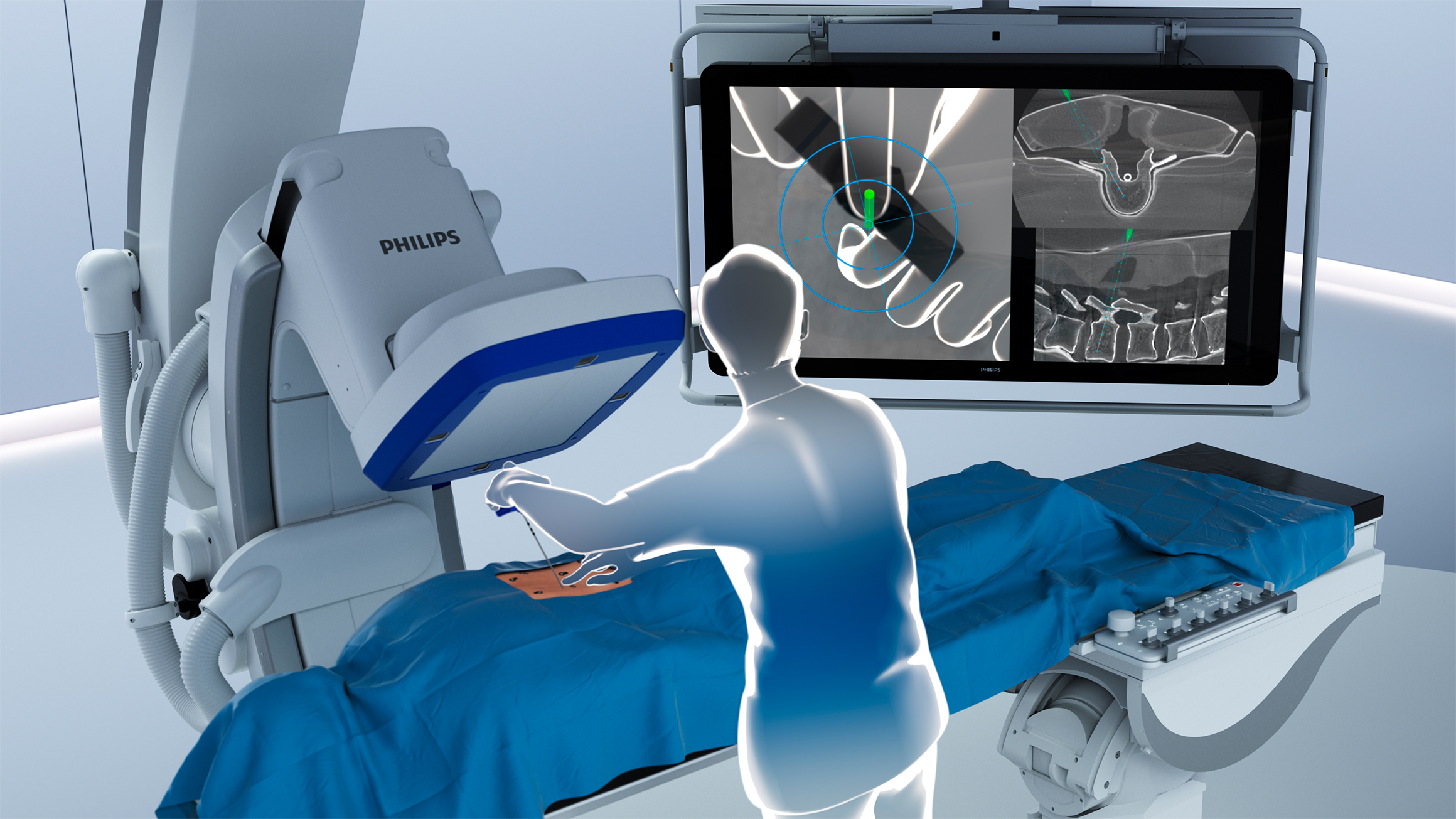 فيليبس تطلق ClarifEye للتوجيه الجراحي المكاني بتقنية الواقع المعزز للارتقاء بآفاق عمليات العمود الفقري ذات الحد الأدنى من التدخل الجراحي