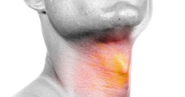اعراض واسباب وعلاج التهاب الحنجرة