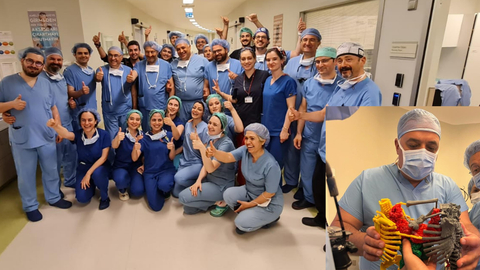 فريق طبي تركي يفصل توأمين ملتصقين في غضون تسع ساعات محطماً الرقم القياسي العالمي