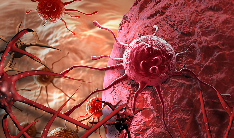 علماء يكتشفون آلية جديدة تُساهم في علاج السرطان