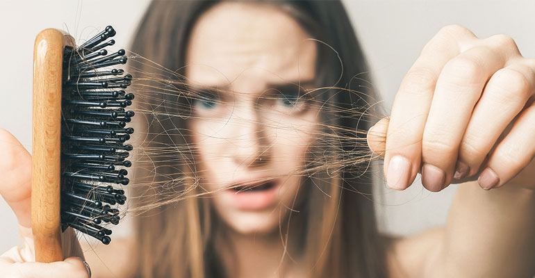 نصائح ضرورية لحلّ مشكلة تساقط الشعر أثناء فترة الرياح الموسمية!